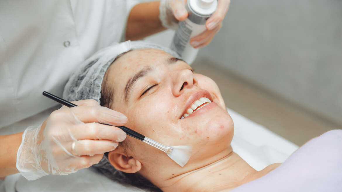 Acne Facial